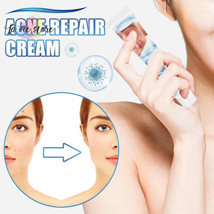 [La vis] Acne Repair Cream Multipurpose Pimple Blackhead Removal Cream