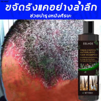 【ดูแลหนังศีรษะ】EELHOE แชมพูขจัดรังแค แชมพูคัน แชมพูยาเชื้อรา 100ml ขจัดรังแค หยุดอาการคัน ลดผมร่วง ยาสระผมขจัดรังแค ดูแลหนังศีรษะ ยาสระผมแก้เชื้อรา ควบคุมน้ำมัน ขจัดรังแค ยาสระผมเชื้อรา แชมพูสมุนไพรยาสระผม ยาสระผมรังแค แชมพูรักษารังแค ยาสระผม