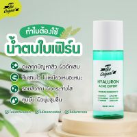 น้ำตบใบเฟิร์น น้ำตบลดสิว The Original Hyaluron Acne Expert 100ml