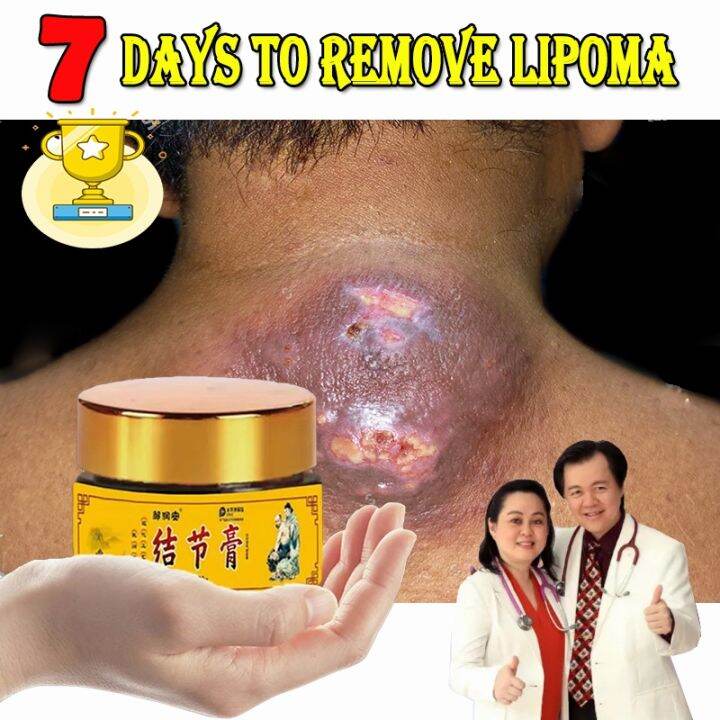 50g lipoma cream/gamot sa bukol/japan lipomas removal cream original ...