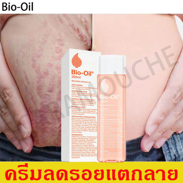 Bio-Oil ครีมทาท้องลาย 200Ml ครีมทารอยแตกลาย ออยทารอยแตกลาย เซรั่มทารอยแตกลาย  ครีมทาขาลาย ครีมรอยแตก ครีมทาลอยเเตก (ครีมกำจัดลอยแตก ครีมทาขาแตกลาย ครีม ลดรอยแตก ครีมทาผิวขาลาย ครีมแก้ขาลาย ครีมทาท้อง ครีมท้องแตกลาย ครีมทาแตกลาย  ครีมรอยแตกลาย ครีมลบรอยแตก ...