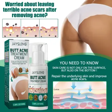Butt Acne Clearing Cream, Butt Thigh Skin Care Clears Buttocks Zits,  Pimples and Dark Spots, Moisturize Cream with Salicylic Acid & Tea Tree,  Skin