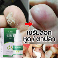 ยาทาตาปลา ยาทาตาปลาหูด เซรั่มลอกหูด ตาปลา ขจัดติ่งเนื้อ Remove Corn  Cream Remove Warts