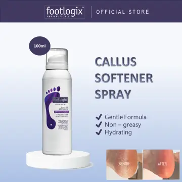 Footlogix Callus Softener With Plastic Handled File by Footlogix