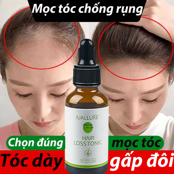 Cách giúp tóc mọc dày trở lại HIỆU QUẢ với 4 yếu tố sau