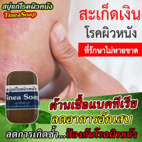 สบู่สมุนไพร 11 ชนิด แก้อาการคันในร่มผ้า แก้แผลอักเสบ (สังฆัง) ผดผื่นคัน กลาก เกลื้อน เป็นวางขอบแดง สบู่พญายอ สบู่พลูคาว สบู่เหงือกปลาหมอ ใช้ง่าย แค่ฟอก