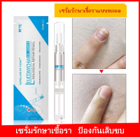 [ส่งจากไทย]VOKเซรั่มรักษาเชื้อรา ป้องกันเล็บขบ แบบทา repair nail