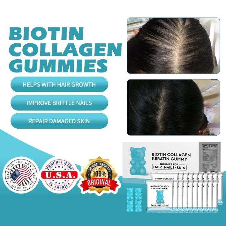 Biotin Collagen Gummies Biotin Supplements Improve Skin Nail Health
