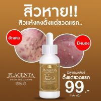 ?พร้อมส่ง เซรั่มรกแกะ?ด้วยนวัตกรรมสารสกัดนำเข้ารกแกะแท้  จากประเทศออสเตรเลีย?? ช่วยเรื่อง ริ้วรอย จุดด่างดำ กระ ฝ้า ?