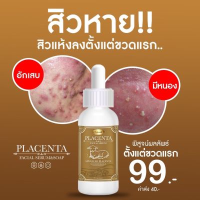 🔥พร้อมส่ง เซรั่มรกแกะ📌ด้วยนวัตกรรมสารสกัดนำเข้ารกแกะแท้  จากประเทศออสเตรเลีย🇦🇺 ช่วยเรื่อง ริ้วรอย จุดด่างดำ กระ ฝ้า 💕