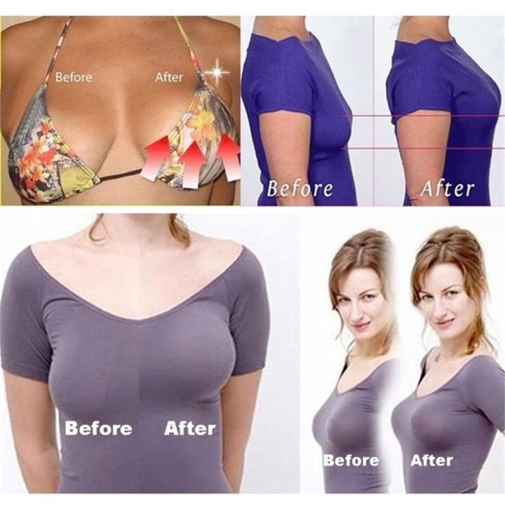 moily-breast-anti-sagging-strapless-lette-anti-stripping-reusable-invisible