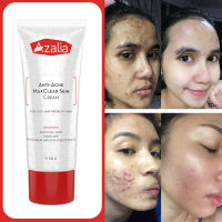 ครีมสำหรับผู้มีปัญหาสิวและผิวมัน เครื่องสำอางสำหรับสิวและขาวใส - Azalia Anti-Acne MaxClear Skin Cream