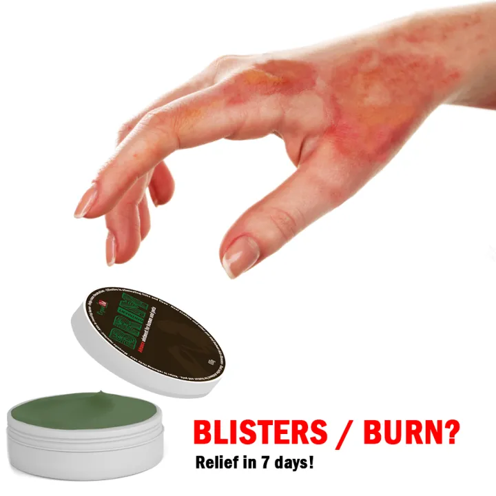 NEW QUALITY! BRIM Advance treatment for Human and Pets , skin burn