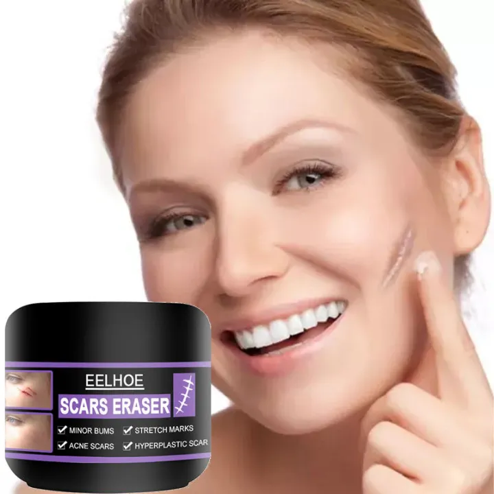 Scar Remover Cream Original Acne Scar Remover Surgery Scar Insect Bites