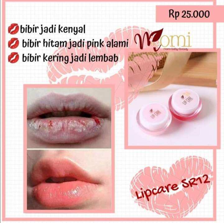 Vitamin Bibir Obat Pecah Pecah Pewarna Bibir Pink Alami Bibir Sehat Lip Care Sr Lazada