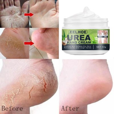 【CW】 Anti Drying Herbal Hand And Foot Cream Heel Cracking Repair Scab Dead Skin Removal Facial Mask Moisturizing Care