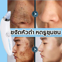 DERMASUCTIONเครื่องดูดสิวหัวดำ พลังดูดสูง ไม่ทำร้ายผิว ดูดซับสิว หัวดูดสูญญากาศ หัวเปลี่ยนได้ 4 หัว ไม่ทำร้ายผิว ทำความสะอาดทั้งใบหน้า และดูแลจมูก(ที่ดูดสิวเสี้ยน เครื่องดูดสิวไฟฟ้า เครื่องดูดสิวเสี้ยน ที่ดูดสิวไฟฟ้าดูดสิวหัวดำ ดูดสิวเสี้ยนอุดตันล เครื่อง