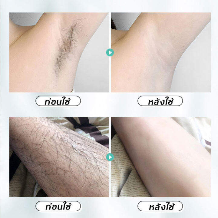 สเปรย์กำจัดขนhair-removal-ขจัดขน-ที่กำจัดขน-มูสโฟมกำจัดขน-ครีมกำจัดขน-ครีมขจัดขน-ครีมกำจัดขนลับ-กำจัดขนขา-แว๊กกำจัดขน-กำจัดขนรักแร้-กำจัดขนน้องสาว-มูสกำจัดขนถาวร-ครีมกำจัดขนขา-มูสกำจัดขนหมอย-ผลิตภัณฑ์