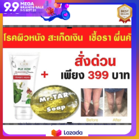 ชุดครีม + สบู๋ สูตรธรรมชาติ-แท้ ผิวหนังอักเสบ สะเก็ดเงิน  เชื้อรา ผื่นคัน