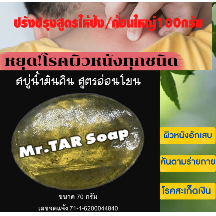 mr-tar-soap-สบู่น้ำมันดิน100กรัมแท้-สูตรอ่อนโยน-สบู่ผิวหนังอักเสบทุกประเภท-สะเก็ดเงิน-ชุดสุดคุ้ม-1-แถม-1-ส่งไว