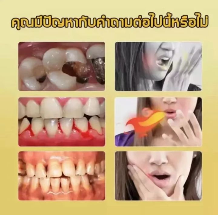 บอกลาฟันผุสไตล์เดียวกัน-จัดส่งทันที-ยาสีฟันฟอกฟันขาว-ยาสีฟันฟันขาว-ยาสีฟันลดหินปูน-ช่องปาก-ยาสีฟันหินปูน-ยาสีฟันจัดฟันฟันขาว-ยาสีฟันขจัดหินปูน-ยาสีฟันขาว