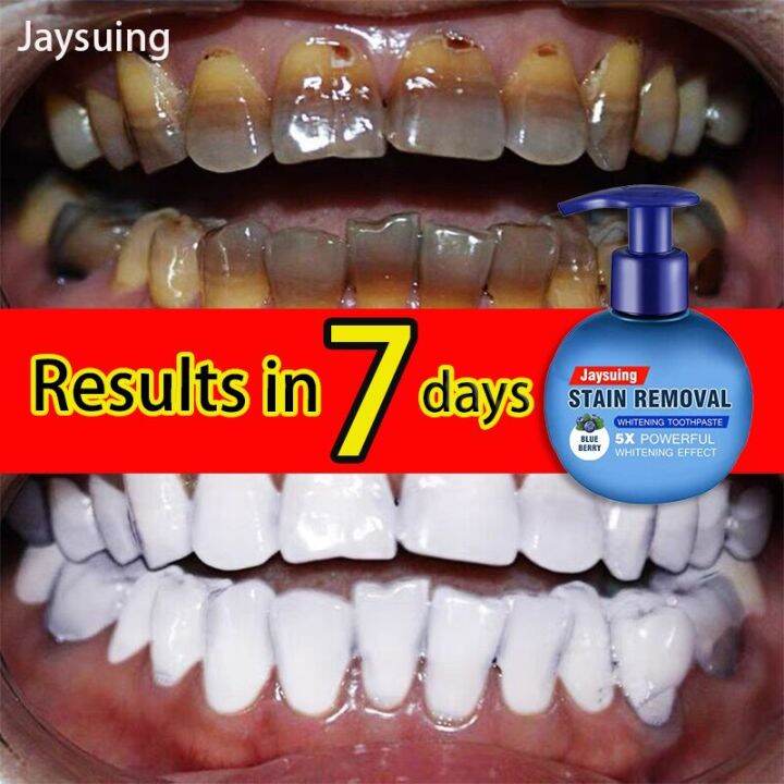 Baking Soda Whitening Toothpaste,Jaysuing Stain Removal Whitening