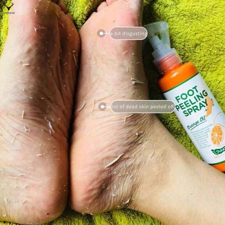 sp-110ml-foot-peeling-spray-elbow-exfoliating-essence-pedicure-cosmetics-for-dead-skin