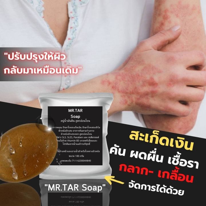 สบู่น้ำมันดิน-mr-tar-soap-100-กรัม-สะเก็ดเงิน-เซบเดิร์ม-ผิวหนังอักเสบ-ผื่นคัน-ผิวหนังอักเสบ-ส่งด่วน