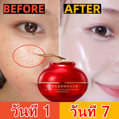 เรตินอล ครีมเลือดมังกร ครีมลบริ้วรอย ครีมหน้าขาวใส 50g ต่อต้านริ้วรอย ลดฝ้ากระ บำรุงผิวและยกกระชับผิว ทำให้  ผิวขาว กระจ่าง