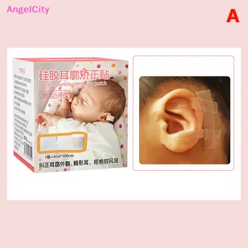 Baby Ear Corrector Auricle Silicone Correction Patch Comfortable Ear Tape  Kids