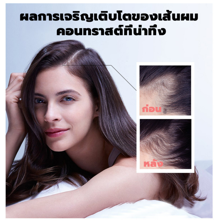 lanemay-hair-serum-เซรั่มบำรุงผม-30ml-1ขวด-เอสเซ้นส์ขิงบำรุงผม-กันร่วง-เซรั่มปกป้องผม-เซรั่มขิงปลูกผม-น้ำยาปลูกผม-บำรุงผม-เซรั่มปลูกผม-ป้องกันผมร่วง-น้ำยาเร่งผมยาว-แชมพูปลูกผมดก-เซรั่มใส่ผม-สเปรย์ปลูก