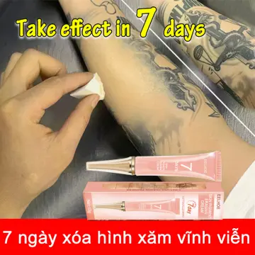 Hướng dẫn cách xóa hình xăm vĩnh viễn hiệu quả và an toàn