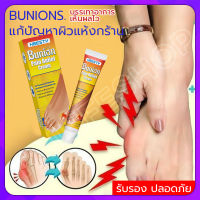 [โปรโมชั่น] เห็นผลไว Bunion cream ลดปวด ลดอักเสบ นิ้วโป้งโค้งงอเข้า Hallux valgus ปวดเท้า ปวดข้อ ปวดบวม ข้ออักเสบ ข้อบวม ข้อต่อนิ้วเท้า บรรเทาอาการ บรรเทาปวด ครีมนวดเท้า ยาแก้ ปวดส้นเท้า （ ยาแก้ปวด แก้ปวดเข่า เจ็บปวดลด ครีมปวดส้นเท้า ปวดข้อเท้า）โปน คด นิ้