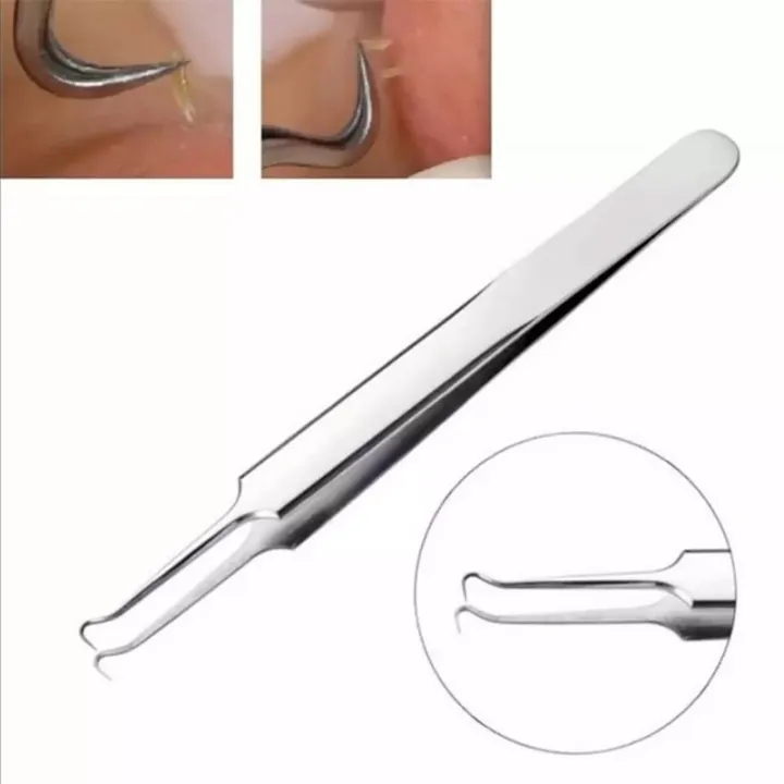 Yesterday Stainless Steel Acne Blackhead Pimple Removal Tool Tweezer