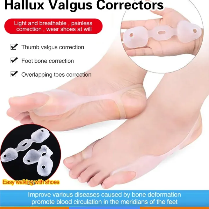 Thumb cyst corrector | Lazada PH