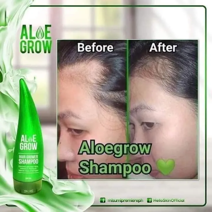 ALOE GROW SHAMPOO Lazada PH