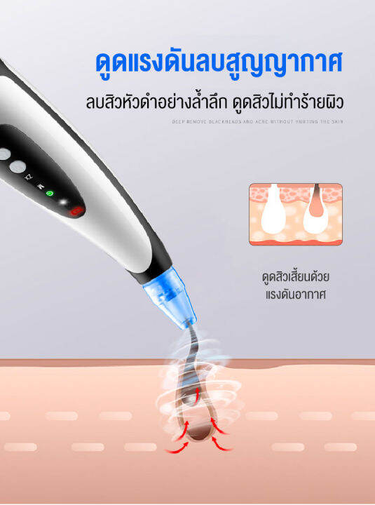 เครื่องดูดสิว-เครื่องดูดสิวไมโครคริสตัล-จอแสดงผล-led-เครื่องดูดสิวหัวดำ-การดูดสิวแบบ3d-ที่ดูดสิวไฟฟ้าดูดสิวหัวดำ-เครื่องมือในการกำจัดสิวหัวดำ-ทำความสะอาดสิวหัวดำ-สิวเสี้ยน-ปรับได้3ระดับ-เปลี่ยนหัวดูได