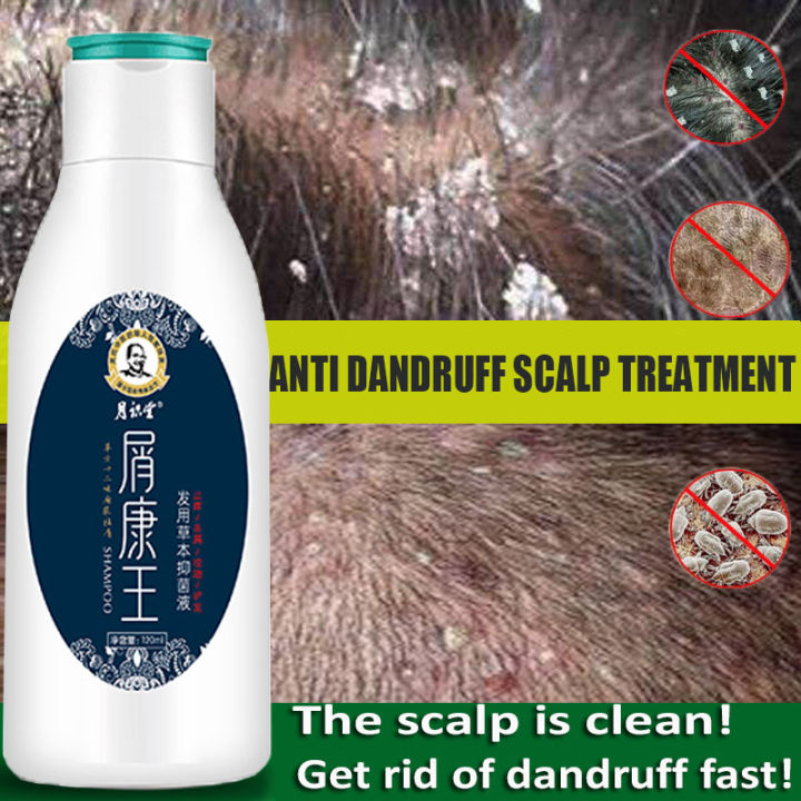 Profissional Scalp Cleansing Shampoo Dandruff Seborrheic 45 Off