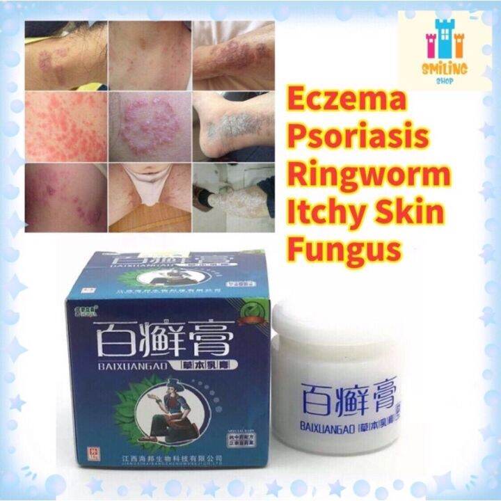 Big Promo Eczema Ringworm Psoriasis Cream Ubat Krim Kurap Ekzema Gatal Psoriasis 百癣膏草本乳膏