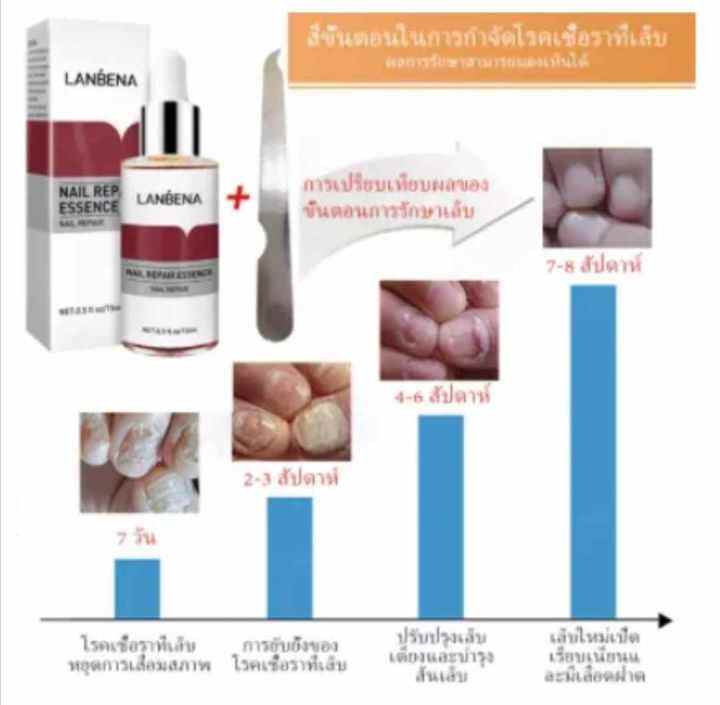 lanbena-เซรั่มเล็บ-บำรุงเล็บ-เล็บขบ-เชื้อรา-ซ่อมแซมเล็บแตก-เล็บเปราะ-เล็บหนา-15ml-แถมฟรี-ตะไบเล็บ