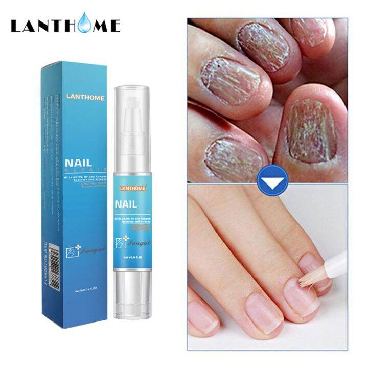 Lanthome Nail Pen Repair Damaged Nails Nail Fungus Treatment Solution
