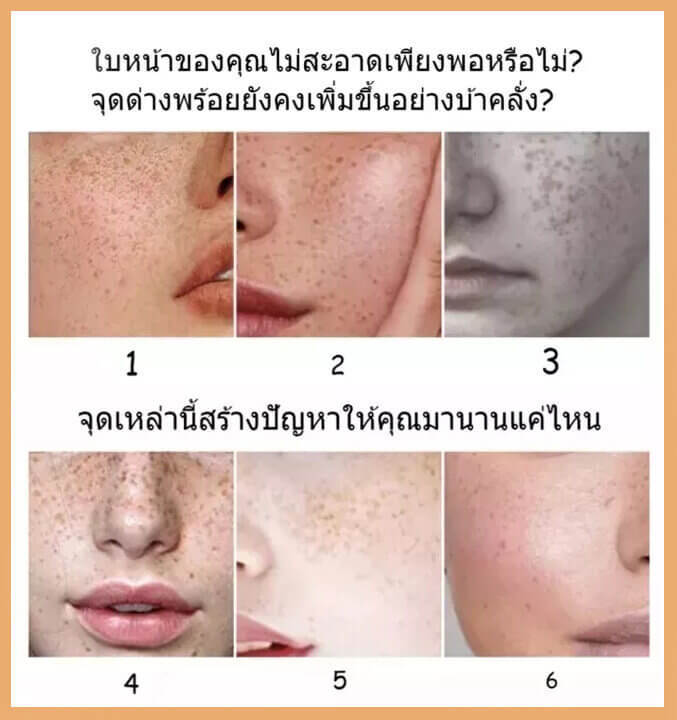 ครีม-แก้-ฝ้า-กระ-vit-c-ครีมทาฝ้ากระ-ครีมหน้าขาวใส-ครีมแก้ฝ้าถาวร-ครีมแก้ฝ้าหนาๆ-ครีมแก้ฝ้าแท้ๆ-ครีมทาหน้าขาว-ลดฝ้ากระ-จุดต่างๆ-ไวท์เทนนิ่ง-ให้ความชุ่มช