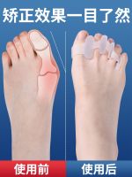 ▥ Thigh bone hallux valgus foot toe big eversion thumb orthotics cloven nursing female separator