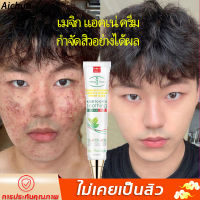 AICHUN เจลแต้มสิว 30g สูตรสมุนไพร ไม่ระคายเคือง รอยสิวจางลง หลุมสิว บอกลาปัญหาสิว เหมาะสำหรับทุกสภาพผิว(ครีมแต้มสิว/ครีมเลือนสิว/เซรั่มเลือนสิว/ครีมลบลอยดำสิว ครีมลบลอยสิว รักษาสิวรอยดำ เจลละลายสิว ครีมลบลอยสิว ครีมแก้สิว ยาคุมสิว)