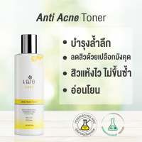 Anti Acne Toner แอนตี้ แอคเน่ โทนเนอร์ แบรนด์ เฌอ สกินแคร์ Cher skincare โทนเนอร์ ทำความสะอาดผิว สำหรับ ผิวเป็นสิว แพ้ง่าย 2 ขนาด 125 และ 250 กรัม