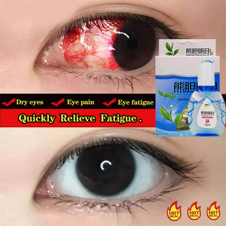 15ml Eye Drops Artificial Tears Relieve Eyes Fatigue Dry Itch Blurred ...