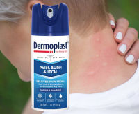 Dermoplast Pain, Burn &amp; Itch Relief Spray for Minor Cuts, Burns and Bug Bites, 2.75 Oz