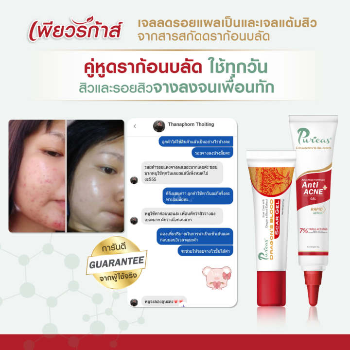 puricas-anti-acne-gel-เพียวริก้า-แอนติ-แอคเน่-เจล-10-กรัม-เจลแต้มสิว