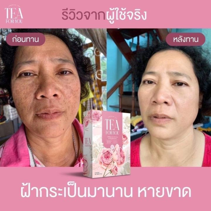 โปร-1-แถม-2-ชาเพื่อคุณ-tea-for-you-ลดตกขาว-ผิวสวย-หน้าใส-ฟิตกระชับ-อัพไซต์