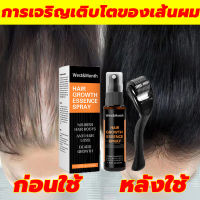 West&amp;Month สเปรย์ปลูกผม30ml แก้ปัญหาผมร่วง ผมสวย เงางาม น้ำยาปลูกผม ป้องกันหัวล้าน ป้องกันผมร่วง รักษาผมร่วง เร่งผมงอกใหม่บำรุงผมฟื้นฟูผมแห้งเสีย เซรั่มปลูกผม น้ำมันปลูกผม ปลูกผม ยาปลูกผม เซรั่มบำรุงผม เชรั่มปลูกผม น้ำยาเร่งผมยาว ยาปลูกผมผู้ชายHair Growth